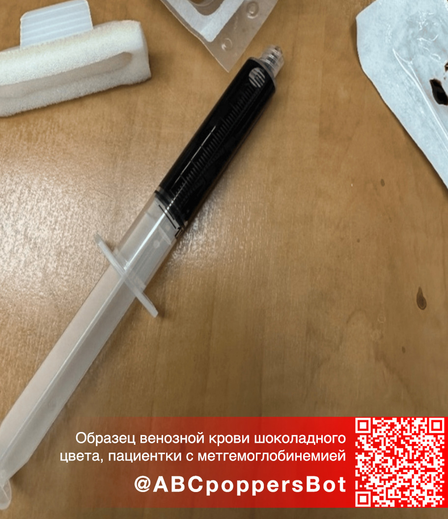 Если принять попперс внутрь в Омске это вызывает метгемоглобинемию. Смертельное состояние Если принять попперс внутрь в Омске это вызывает метгемоглобинемию. Смертельное состояние